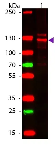 Anti-Collagen I + Collagen III antibody(AB34710)