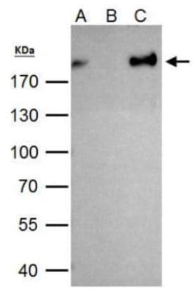 Anti-ZEB1 antibody(AB155249)