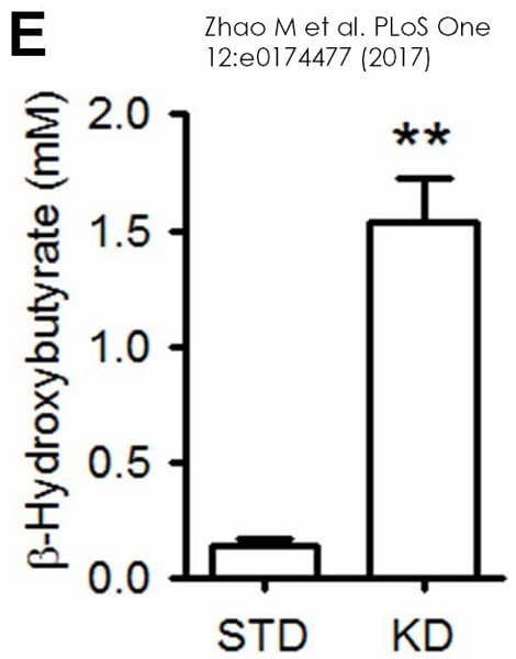 beta Hydroxybutyrate (beta HB) Assay Kit (Colorimetric)(ab83390)