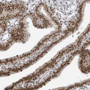 Anti-YTHDC1 antibody(AB122340)