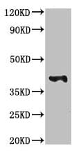 Anti-MAdCAM1 antibody(AB237020)