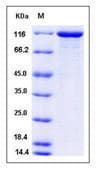Recombinant Human Vinculin protein (His tag)(AB276192)