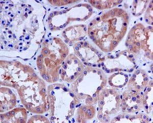 Hdac6 Antibody Epr16982 Ab133493  Immunohistochemistry Formalin Pfa Fixed Paraffin Embedded Sections Img126872