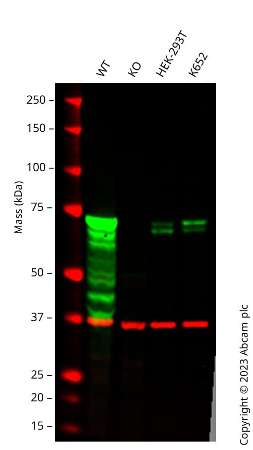 Syk Antibody Ep573y Ab40781  Western Blot Img422034