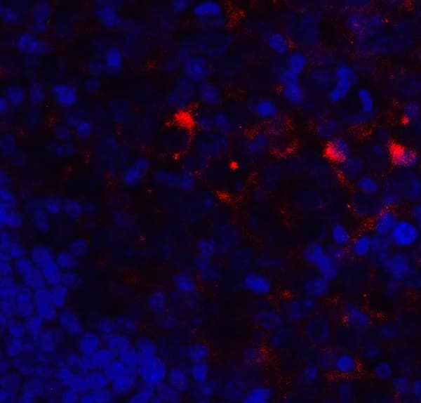 Anti-VISTA antibody(AB254581)