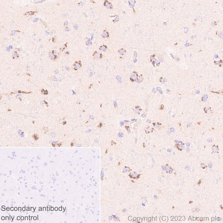 Anti-KIAA0319L antibody [EPR28329-62](AB315027)