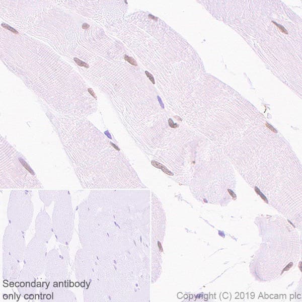 Six1 Antibody 1593 Ab243247  Immunohistochemistry Formalin Pfa Fixed Paraffin Embedded Sections Img117552