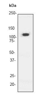 Anti-delta 1 Catenin/CAS antibody [YE372] - BSA and Azide free(AB247228)