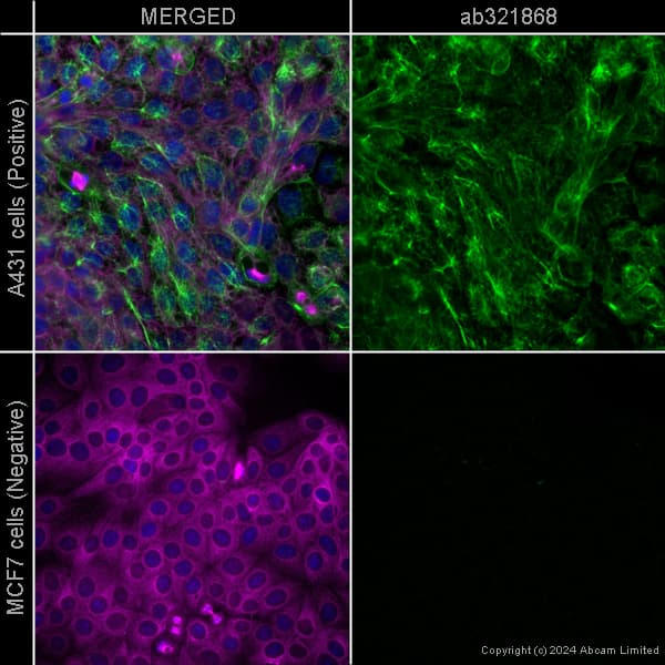 Alexa Fluor 594 Alpha Tubulin Antibody Ep1332y Microtubule Marker Ab202272  Immunocytochemistry Immunofluorescence Img436057