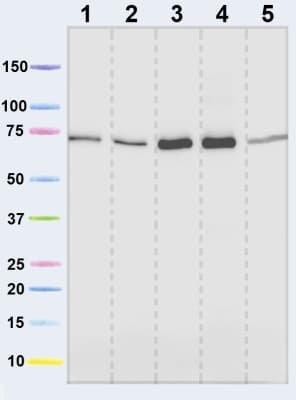 Anti-SDHA antibody [2E3GC12FB2AE2](AB14715)