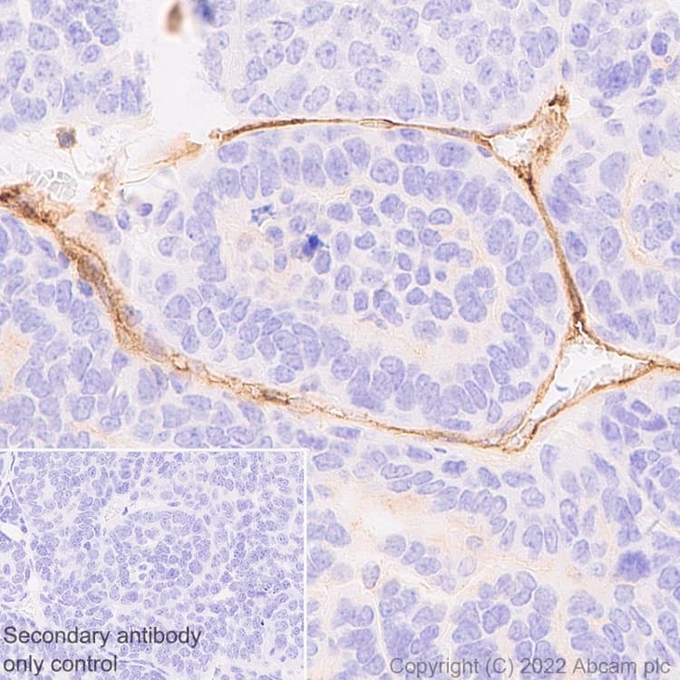 Anti-uPA Receptor/U-PAR antibody [EPR26916-73](AB307895)