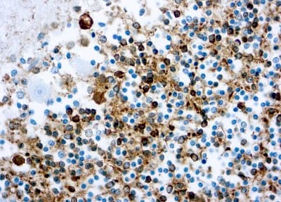 Anti-Tau antibody [Tau46](AB203179)