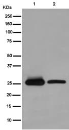 Qdpr Dhpr Antibody Ep12595 Ab186411  Western Blot Img56930
