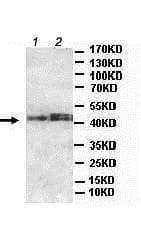 B3galnt1 Antibody Ab176891  Western Blot Img568