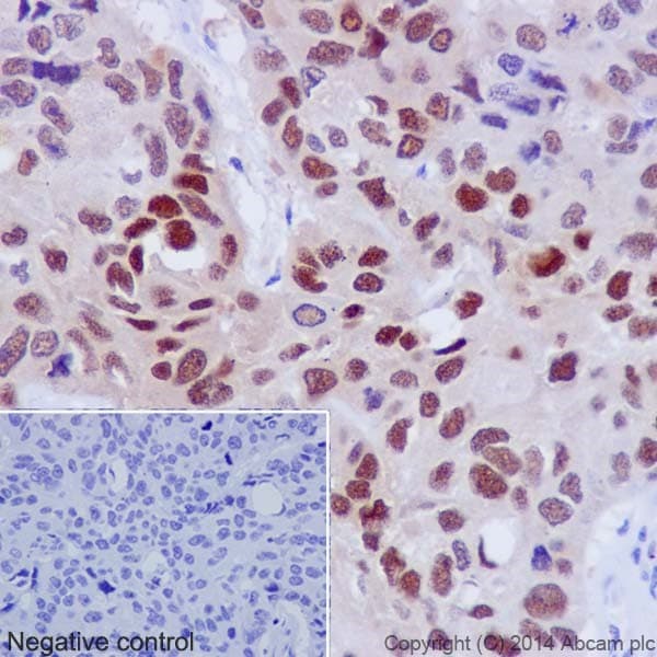 Hsp70 Antibody Epr17677 Ab182844  Immunohistochemistry Formalin Pfa Fixed Paraffin Embedded Sections Img120500