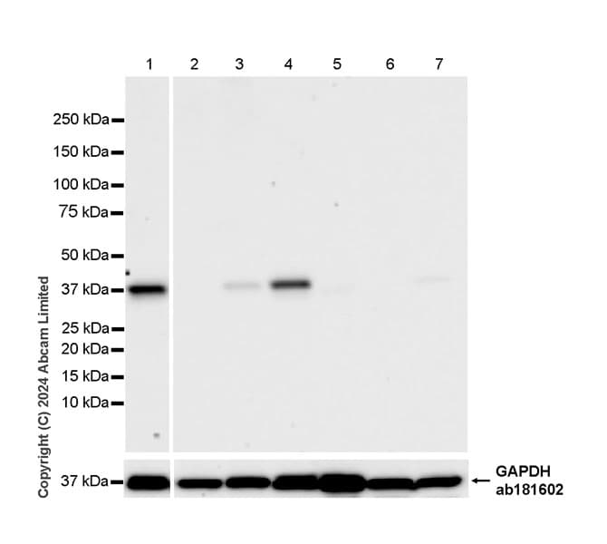 Atp6v0d2 Antibody Epr29173 521 Bsa And Azide Free Ab321810  Western Blot Img435518