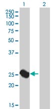 Ab94082  Western Blot Img143494