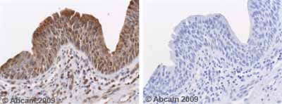 Mmp10 Antibody Ab38930  Immunohistochemistry Formalin Pfa Fixed Paraffin Embedded Sections Img33809