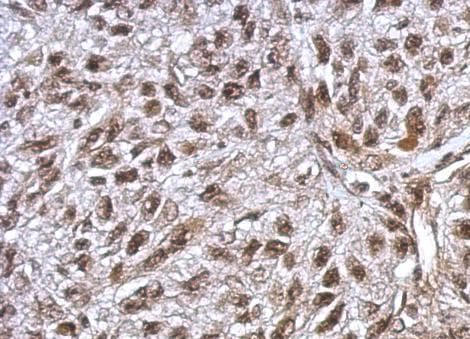 Anti-FLI1 antibody(AB153909)