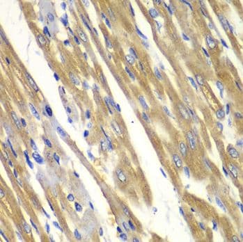 Anti-Tyrosinase antibody(AB180753)