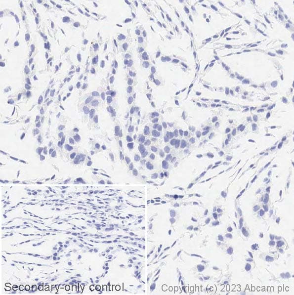 Anti-Cytokeratin 14 antibody [LL002](ab7800)