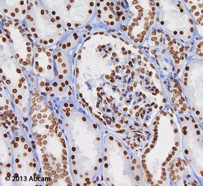 Anti-Histone H3 (di methyl K9) antibody [mAbcam 1220] - ChIP Grade(AB1220)
