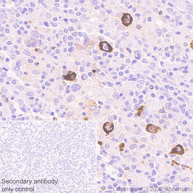 Ccl3 Mip 1 Alpha Ccl3l1 Antibody Epr23751 54 Ab259372  Immunohistochemistry Formalin Pfa Fixed Paraffin Embedded Sections Img130896