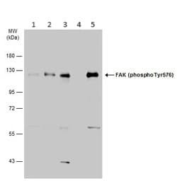 Anti-FAK (phospho Y576) antibody(AB226847)