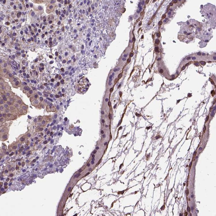 Anti-Amphiregulin antibody(AB224350)