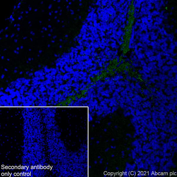 Myelin Plp Antibody Plpc 1 Ab9311  Immunohistochemistry Frozen Sections Img174700