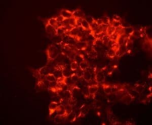 Anti-M6PR (cation independent) antibody [EPR6599](AB124767)