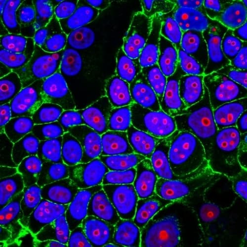 Cyclin B1 Antibody Ccnb1 1098 Ab212977  Immunocytochemistry Img125709