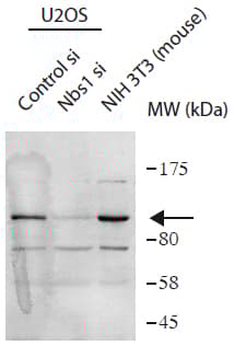 Anti-p95/NBS1 antibody(AB175800)