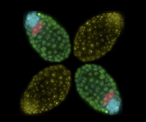 Anti-Histone H3 (tri methyl K27) antibody [mAbcam 6002] - ChIP Grade(AB6002)