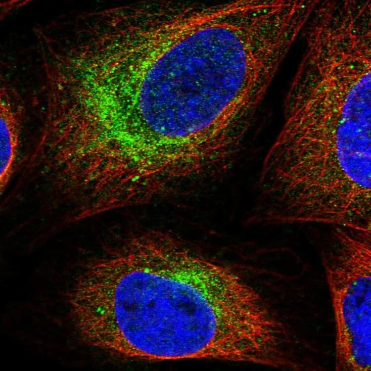Scn3b Antibody Ab254861  Immunocytochemistry Immunofluorescence Img94586