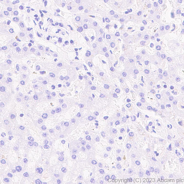 Anti-Aldose reductase antibody [EPR28780-7] - BSA and Azide free(AB316017)