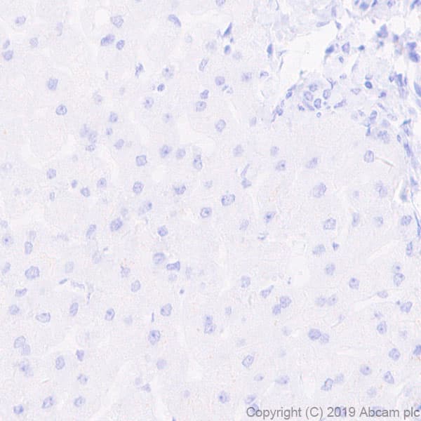 Anti-Pan Trk antibody [EPR17341-4](ab246551)