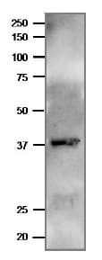 Anti-Ferredoxin--NADP reductase, apicoplast antibody(AB243175)