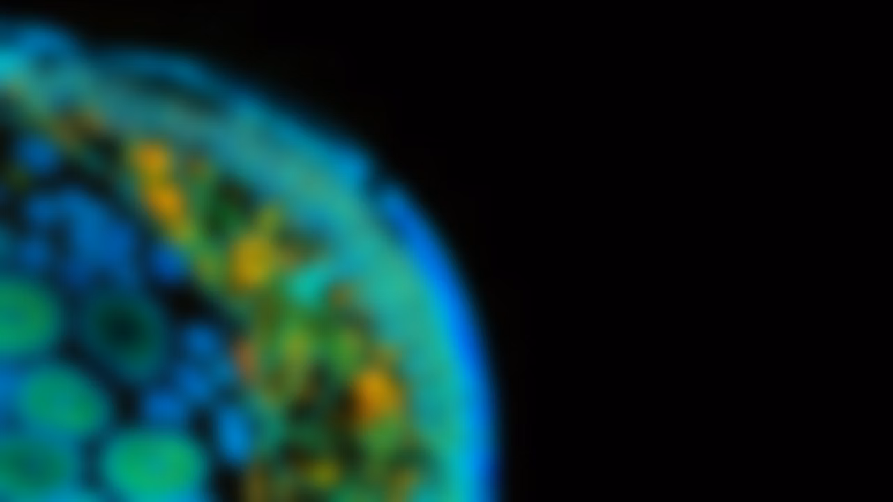 Lms Lasx Ls Software Lifescience Blur Roundworm Kid21766969