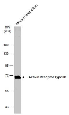 Anti-Activin Receptor Type IIB/ACVR2B antibody(AB272869)