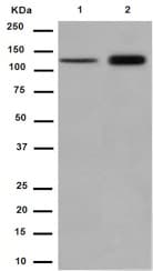 Rbm6 Antibody Epr15842 C Terminal Ab188318  Western Blot Img60677