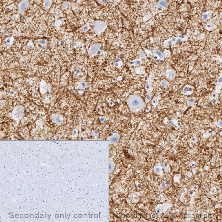 Anti-Myelin Basic Protein antibody [EPR21188](AB218011)