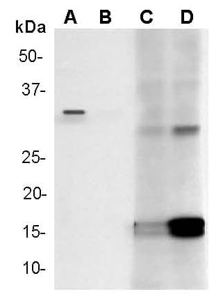 Anti-Cleaved Caspase-3 antibody [E83-77](AB32042)