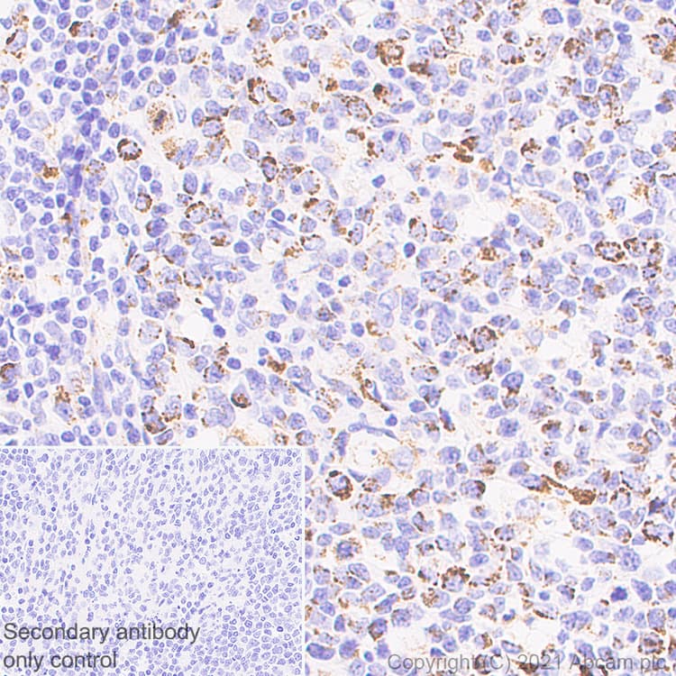 Anti-LRPPRC/GP130 antibody [EPR24052-38](AB259927)
