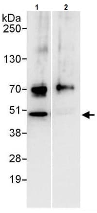 Pabpn1 Antibody Ab241477  Immunoprecipitation Img126514
