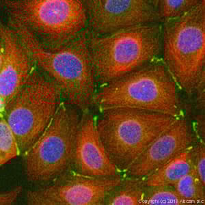 Anti-ZO1 tight junction protein antibody(AB216880)