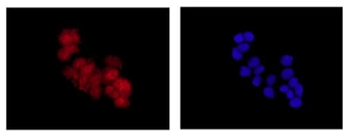 Anti-PHD finger protein 1/PHF1 antibody [EPR14222](AB184951)