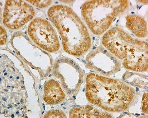 Txnrd1 Antibody Epr10205 Ab167411  Immunohistochemistry Formalin Pfa Fixed Paraffin Embedded Sections Img71707