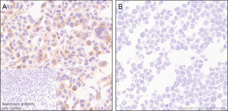 Muc17 Antibody Epr28482 85 Ab316971  Immunohistochemistry Formalin Pfa Fixed Paraffin Embedded Sections Img429266