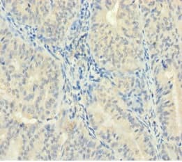 Zmat5 Antibody Ab235355  Immunohistochemistry Formalin Pfa Fixed Paraffin Embedded Sections Img58329